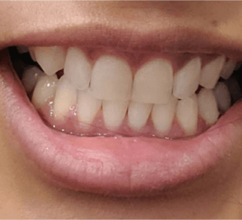 Times Dental After Treatment