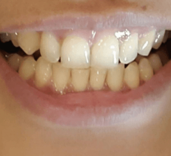Times Dental Before Treatment