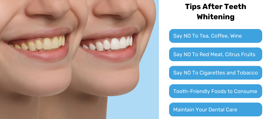 Tips-After-Teeth-Whitening